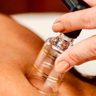 Cupping Massage